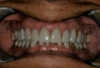 Konig Center for Cosmetic & Comprehensive Dentistry smile photos